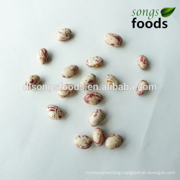 Kidney Buyer,Kidney Beans Soya Bean